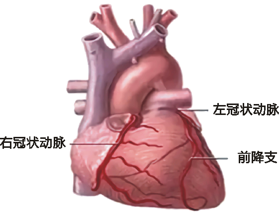 冠状动脉造影术