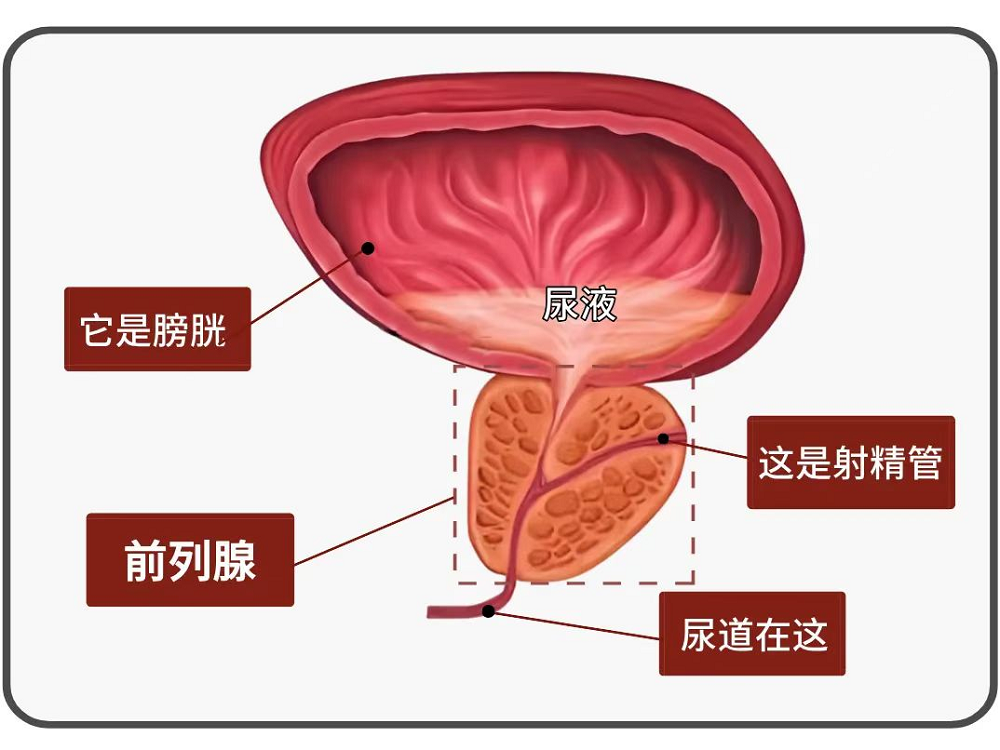尿频、尿急、排尿难...80%的男性可能遭遇的前列腺问题，热蒸汽一招破解