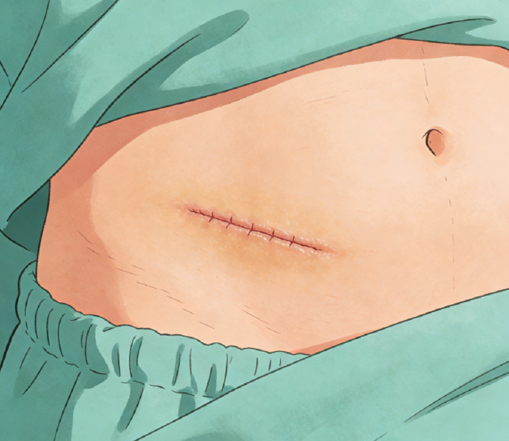 直肠癌术后出现腹痛怎么办？医生解答